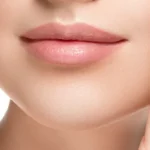 Close up of a womans soft lips How Long Do Lip Fillers Really Last? Everything You Need to Know